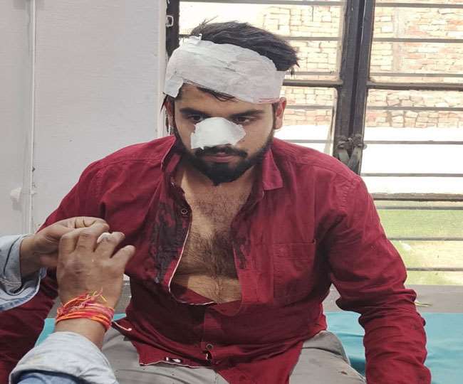 बाइक पर कालेज जा रहे भाजपा नेता के भतीजे और उसके दोस्‍त पर धारदार हथियारों से हमला, आठ पर मुकदमा दर्ज